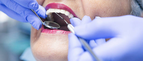 Best Emergency Treatment for Dental Infections or Abscesses in Benton, IL